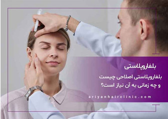بلفاروپلاستی اصلاحی چیست و چه زمانی به آن نیاز است؟